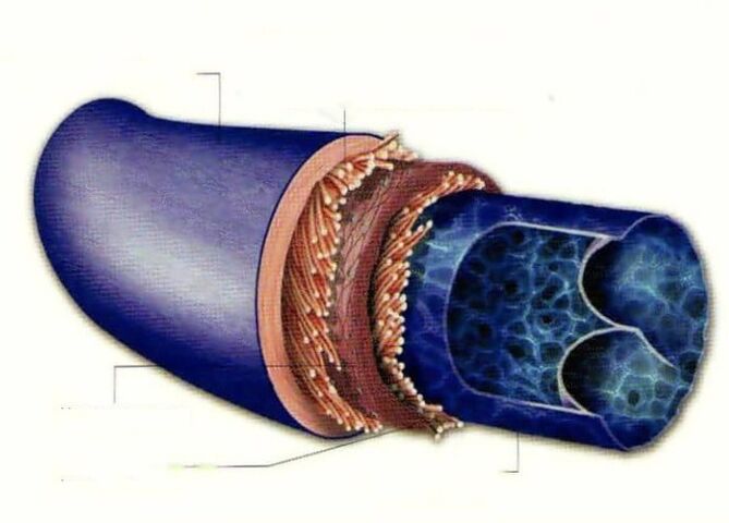 The cause of varicose veins