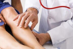 Varicose veins on the feet