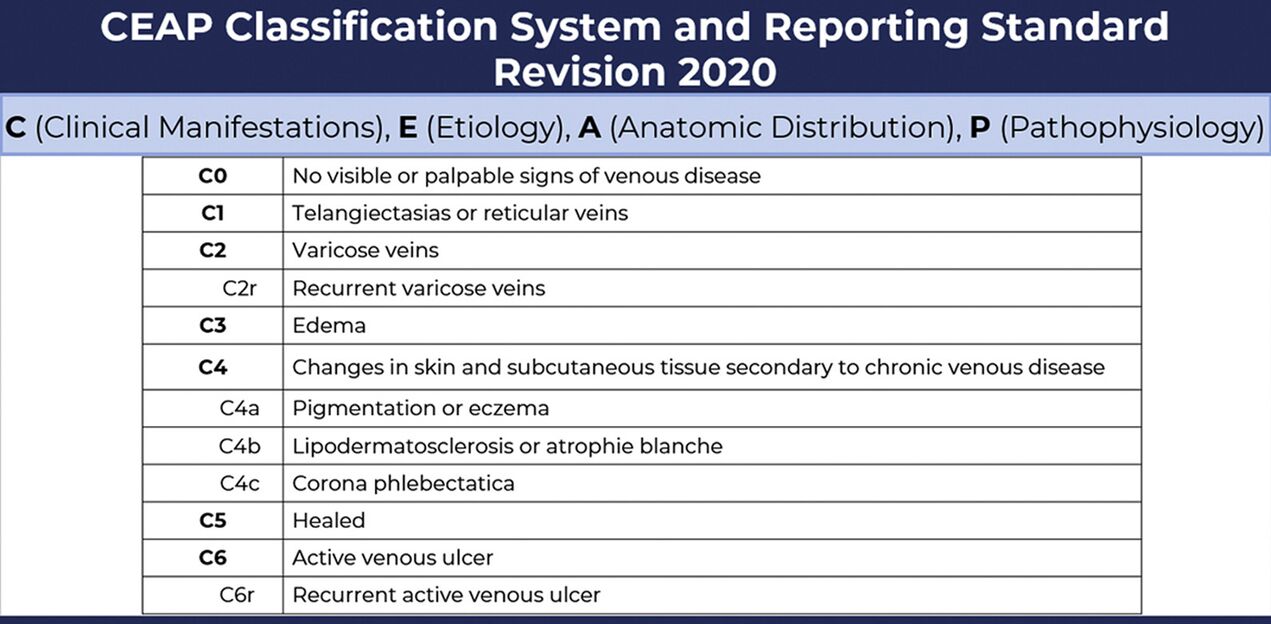 The stage of varicose veins according to the CEAP classification as amended in 2020